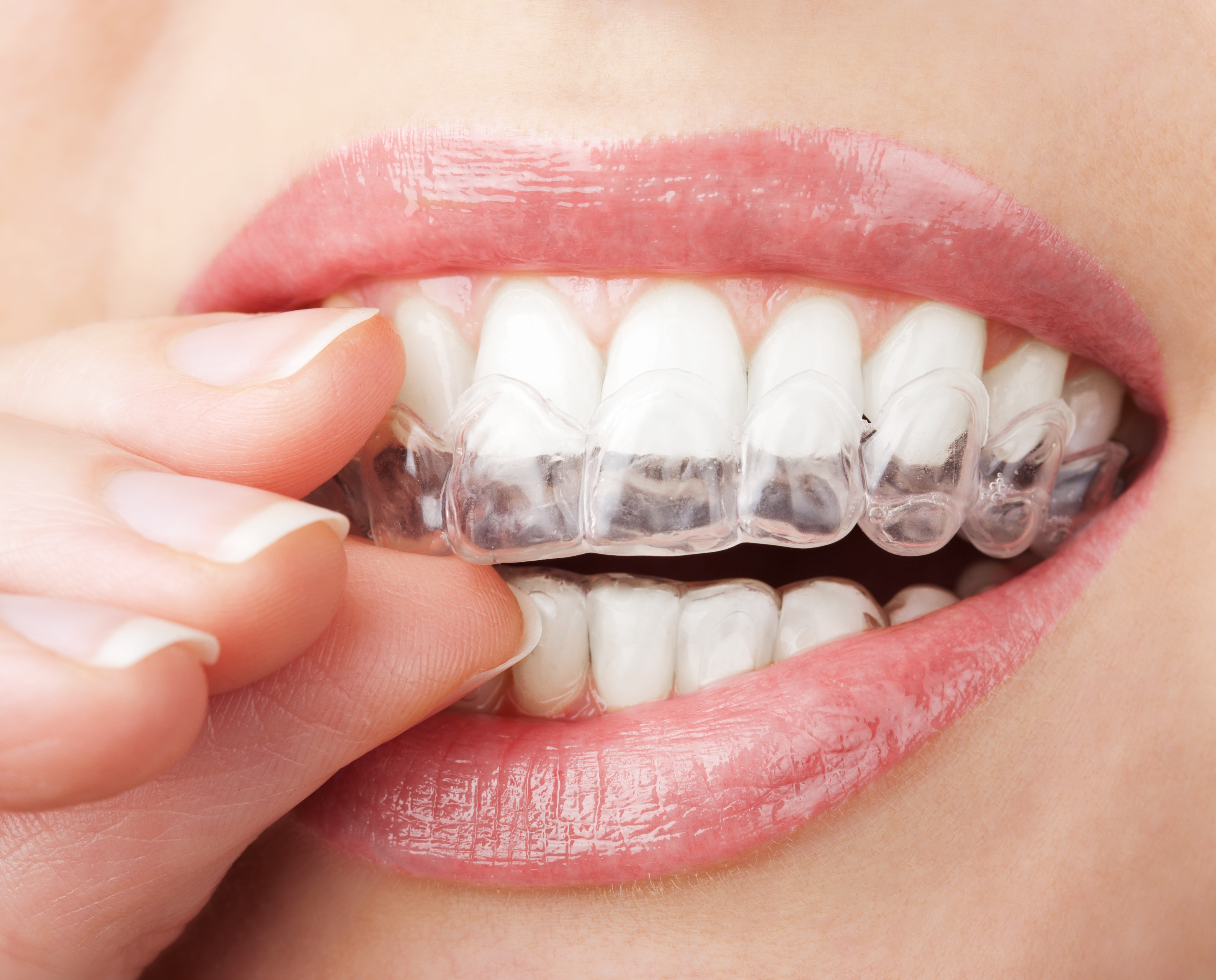 5 Main Errors to Keep away from Whereas Brushing Your Enamel