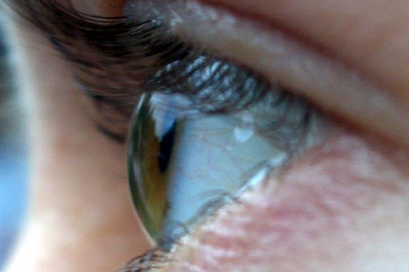 Top Factors to Consider when Choosing an Eye Clinic